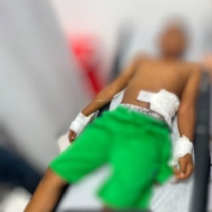 Niño de 11 años resulta herido con arma casera