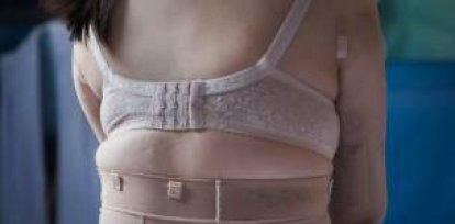 Las mujeres que se arrepintieron hacerse cirugía estética,Las mujeres que se arrepintieron hacerse cirugía estética