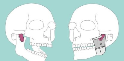 mandíbula,mandíbula