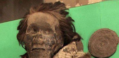 Los piojos “momificados” pueden abrir una interesante ventana al pasado,Los piojos “momificados” pueden abrir una interesante ventana al pasado