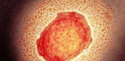 Todo lo que hay que saber sobre la viruela del mono,Todo lo que hay que saber sobre la viruela del mono