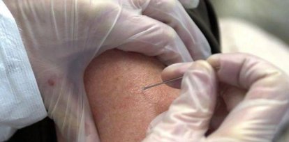 Todo lo que hay que saber sobre la viruela del mono,Todo lo que hay que saber sobre la viruela del mono