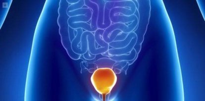 Día Mundial del Cáncer de Vejiga: Señales a las que debería ponerle atención,Día Mundial del Cáncer de Vejiga: Señales a las que debería ponerle atención