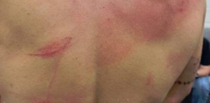 Fotos: Así quedó Bad Bunny tras pelea en la WWE,Fotos: Así quedó Bad Bunny tras pelea en la WWE