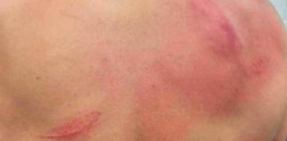 Fotos: Así quedó Bad Bunny tras pelea en la WWE,Fotos: Así quedó Bad Bunny tras pelea en la WWE