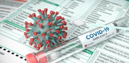 OMS: Nos preocupa que el nivel de control de COVID se esté reduciendo,OMS: Nos preocupa que el nivel de control de COVID se esté reduciendo