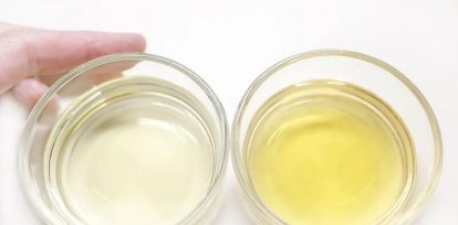 ¿Por qué los sobrevivientes orinaban negro en «La sociedad de la nieve»?,¿Por qué los sobrevivientes orinaban negro en «La sociedad de la nieve»?