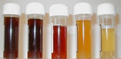 ¿Por qué los sobrevivientes orinaban negro en «La sociedad de la nieve»?,¿Por qué los sobrevivientes orinaban negro en «La sociedad de la nieve»?