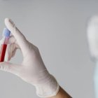 Detecta el cáncer en sus primeras etapas.  Internet