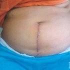 Fiscalía  SD llama acusada de herir mujer con cuchillo