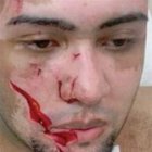 Adolescente  corta  cara a joven; le desfigura el rostro