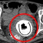 juguete sexual en la vagina