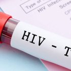 ¿Cuál-es-situación-actual-del-VIHSIDA-en-el-mundo