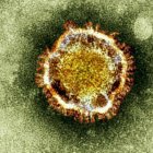 El coronavirus. Foto de archivo AP. 