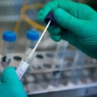 Coronavirus RD / Fuente externa 