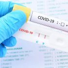 Descriptiva - Externa