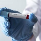 Se-1elevan-a-880-los-muertos-por-coronavirus-y-a-43-114-los-contagiados-en-República-Dominicana
