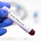 Prueba de coronavirus. 