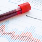 nivel-normal-azucar-en-sangre