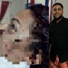 El agresor le habría dado 11 estocadas. Huyó.