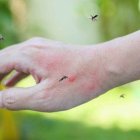 Los mosquitos pueden ser atraídos  por el olor de la piel.