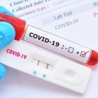 Pruebas COVID (Fuente externa).