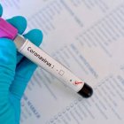 Prueba COVID-19 (Fuente externa)