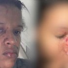 Madre e hija fueron agredidas.