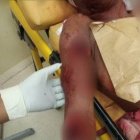 4 Perros casi matan una mujer en iglesia Nuestra Señora del Carmen de Haras Nacionales