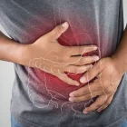 Cáncer de colon y recto 