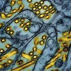 Foto de microscopio difundida por el Instituto Nacional de Alergias y Enfermedades Infecciosas de Estados Unidos el 26 de marzo del 2024, que muestra partículas de la gripe aviar. (CDC/NIAID via AP)