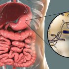 La bacteria Helicobacter pylori aumenta el riesgo de desarrollar úlceras, gastritis crónica e incluso cáncer de estómago (Shutterstock)