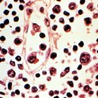 Hantavirus: qué es, cómo se contagia, situación en RD, prevención y por qué no sería otro covid-19