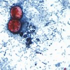 Quistes de Cyclosplora.  AP