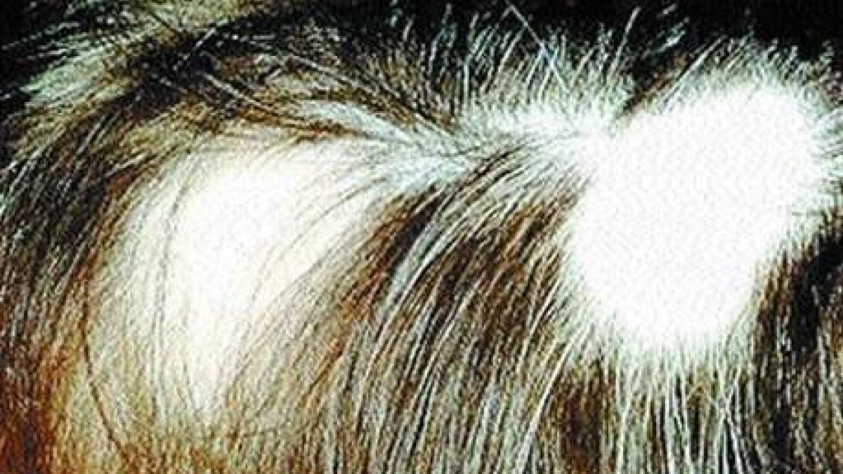 ¡Se me cae el cabello! ¿Qué hago?