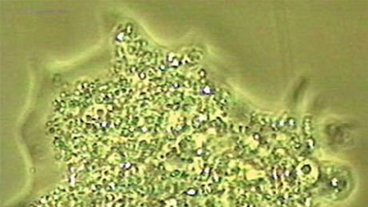 ¿Qué es la amebiasis?