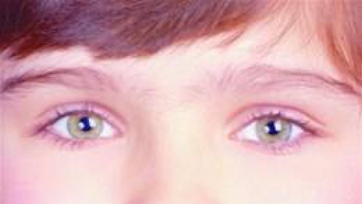 Dientes sanos Meta en el mes de la salud oral