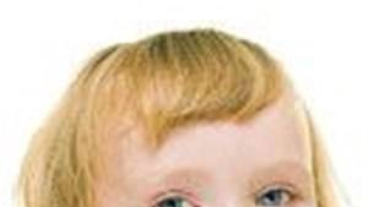 ¿Qué es la pitiriasis versicolor?