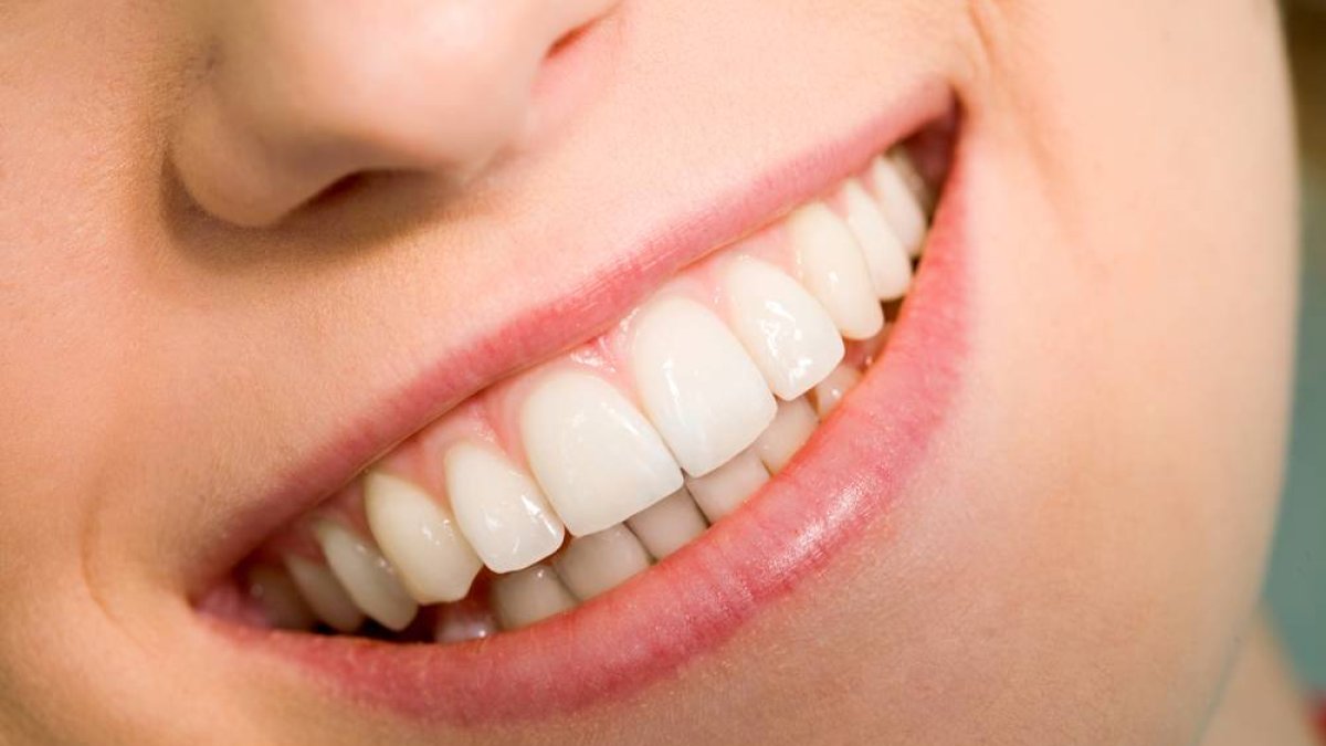 Ortodoncia, estética dental