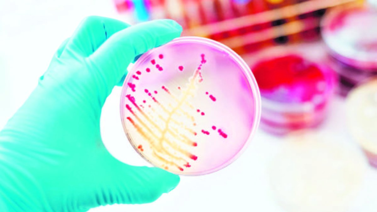 La Organización Panamericana de la Salud (OPS), indicó que se habían registrado casos en Venezuela, Haití y Brasil