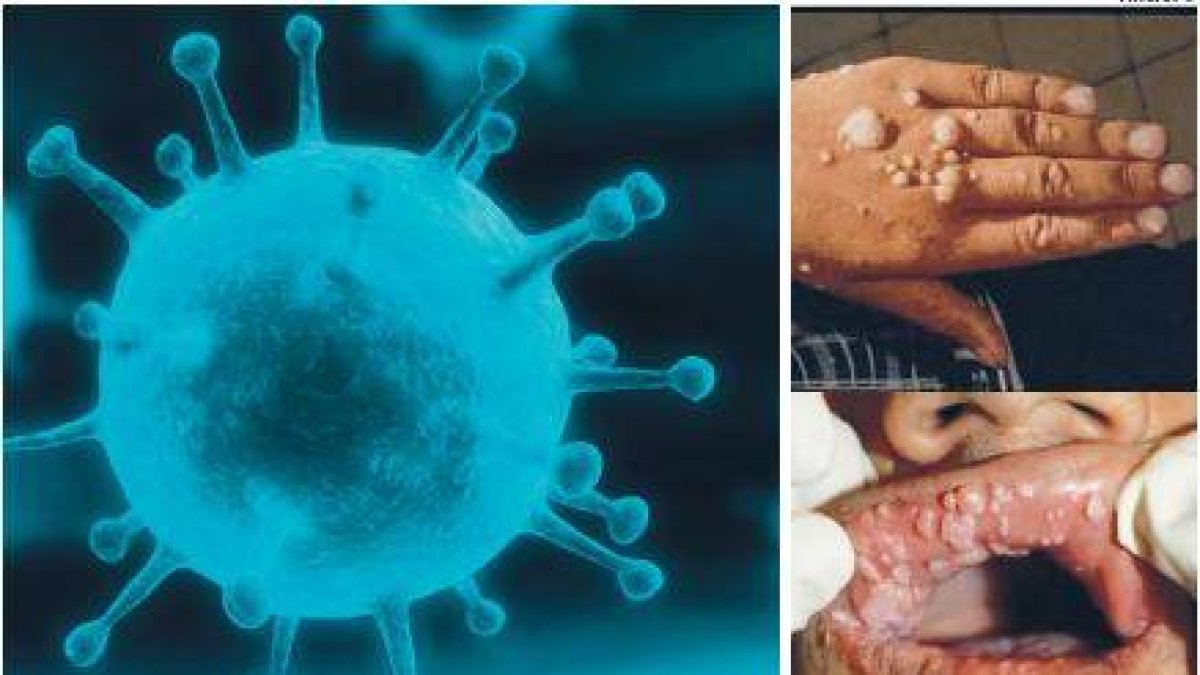 Todo lo que tienes que saber sobre el virus del papiloma humano y sus vacunas