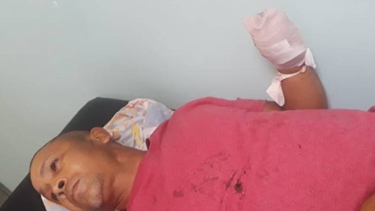 Cortan mano izquierda a concejal durante una riña a machetazos en Dajabón