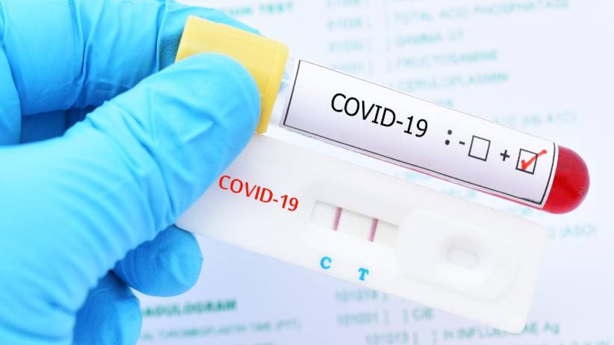 Prueba-PCR-prueba-rapida-coronavirus