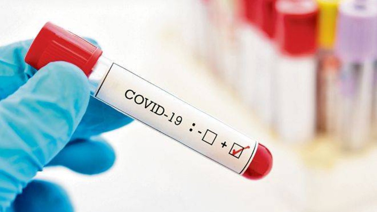 Pruebas COVID-19 (Fuente externa)