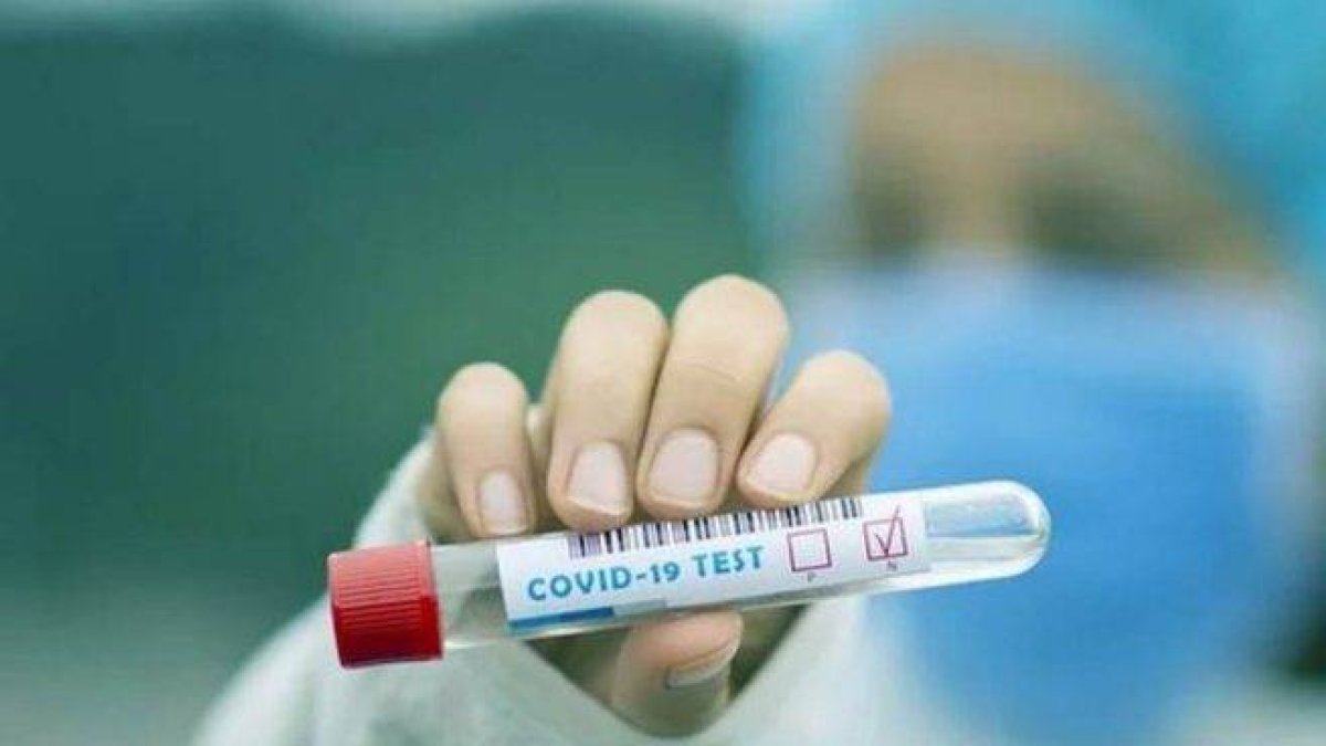 Suben a 1,544 los casos nuevos covid-19 en República Dominicana