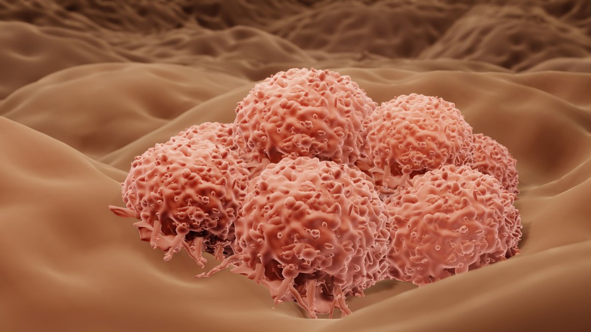 El cáncer en hombres se duplicará en 2050, con amplias disparidades por la edad o economía