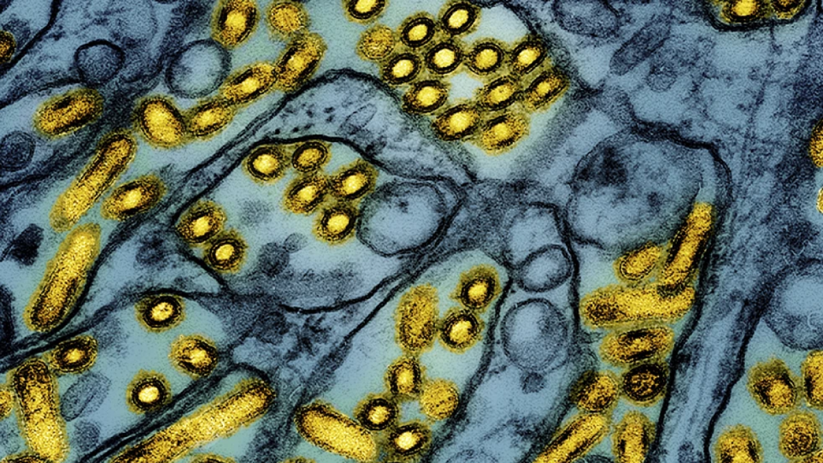 Foto de microscopio difundida por el Instituto Nacional de Alergias y Enfermedades Infecciosas de Estados Unidos el 26 de marzo del 2024, que muestra partículas de la gripe aviar. (CDC/NIAID via AP)