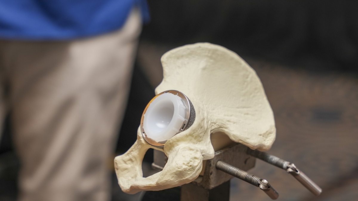 FOTO Sistema de copa acetabular G7 en pelvis