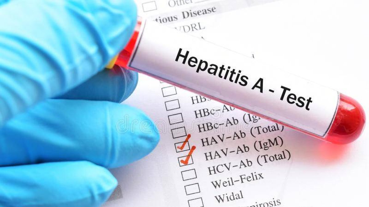Prueba de hepatitis A (Fuente externa)