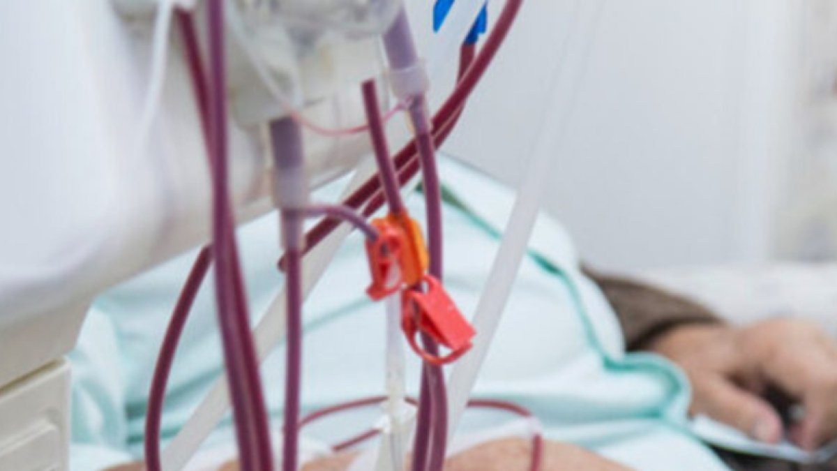 La diálisis es un tratamiento largo para pacientes.